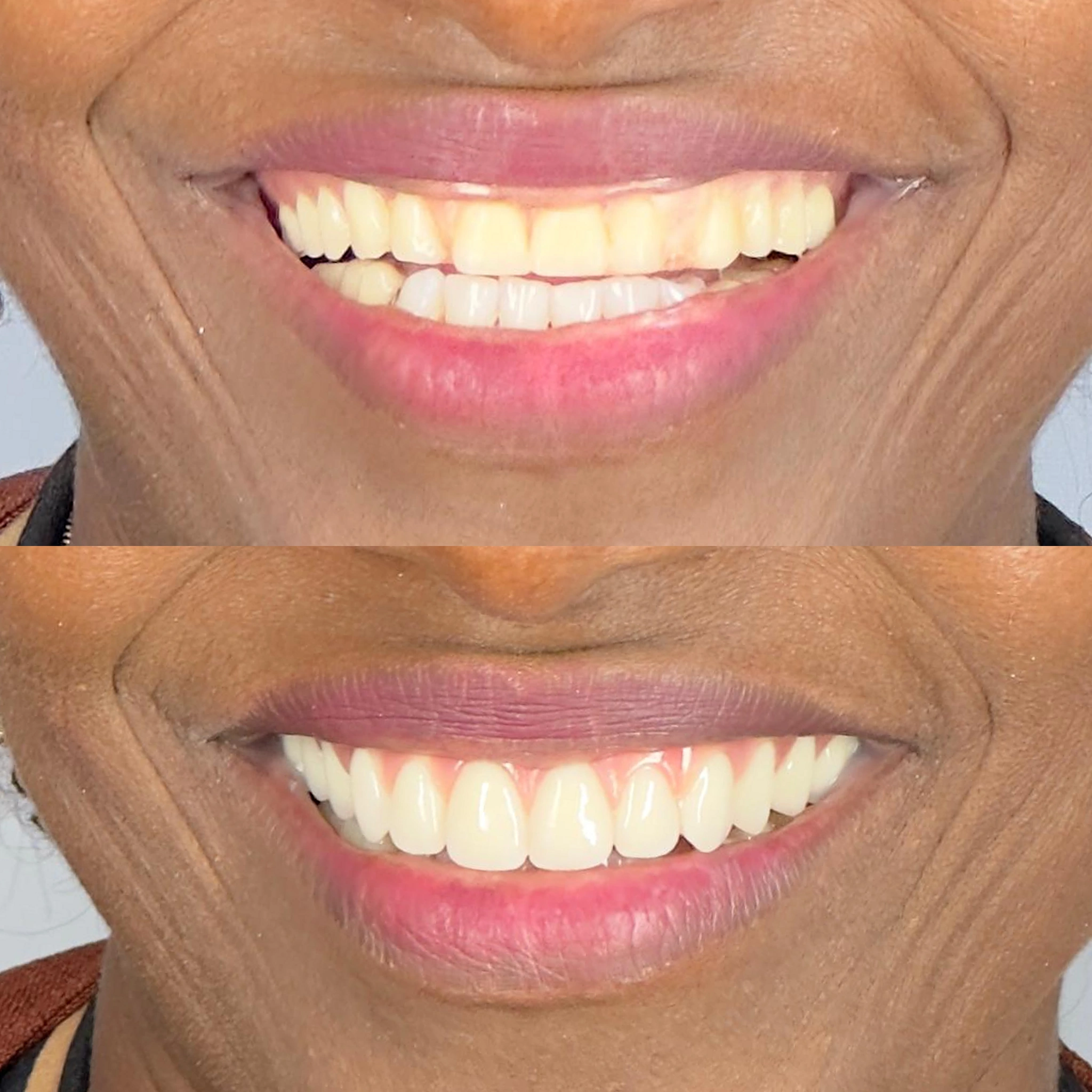 antes-depois-1