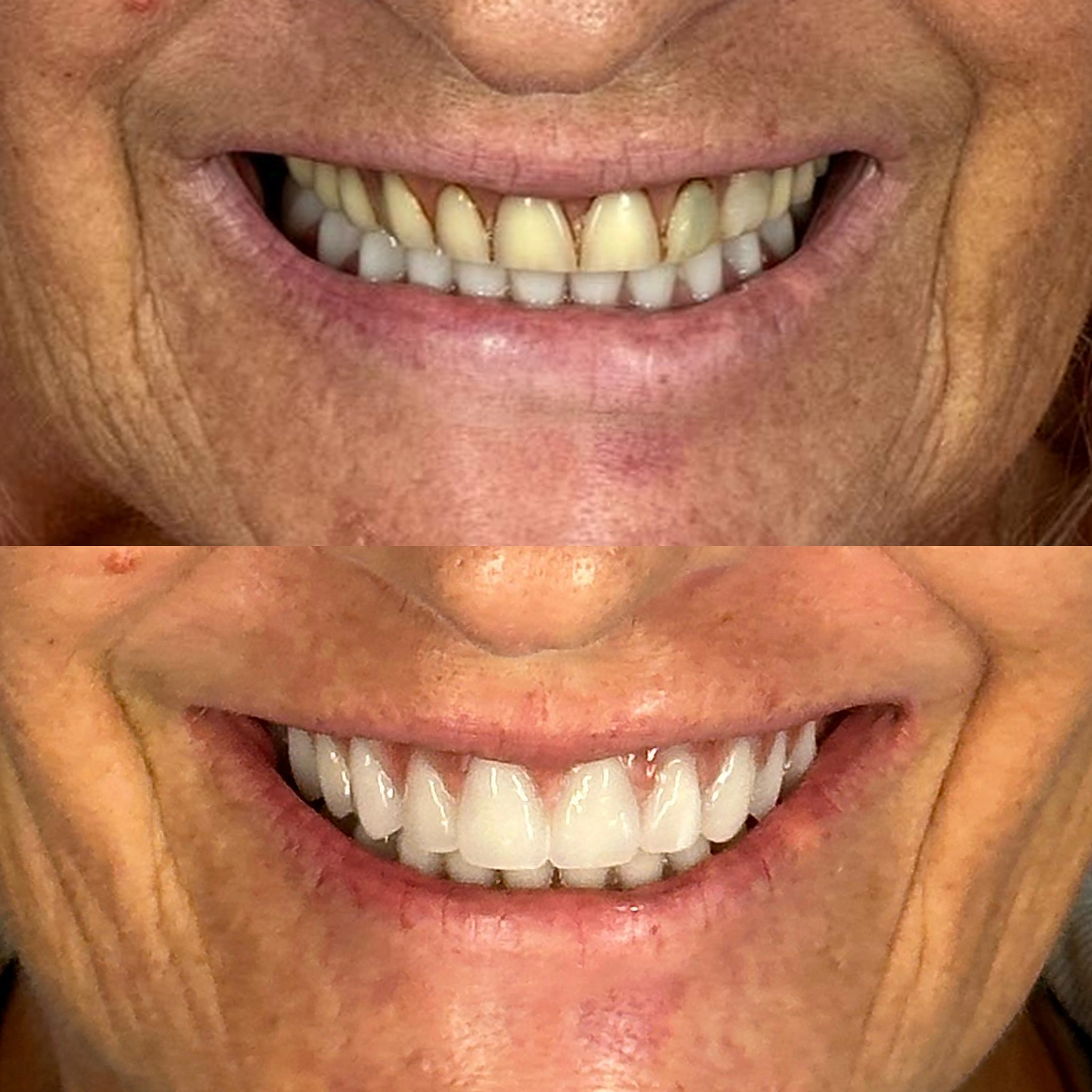 antes-depois-2