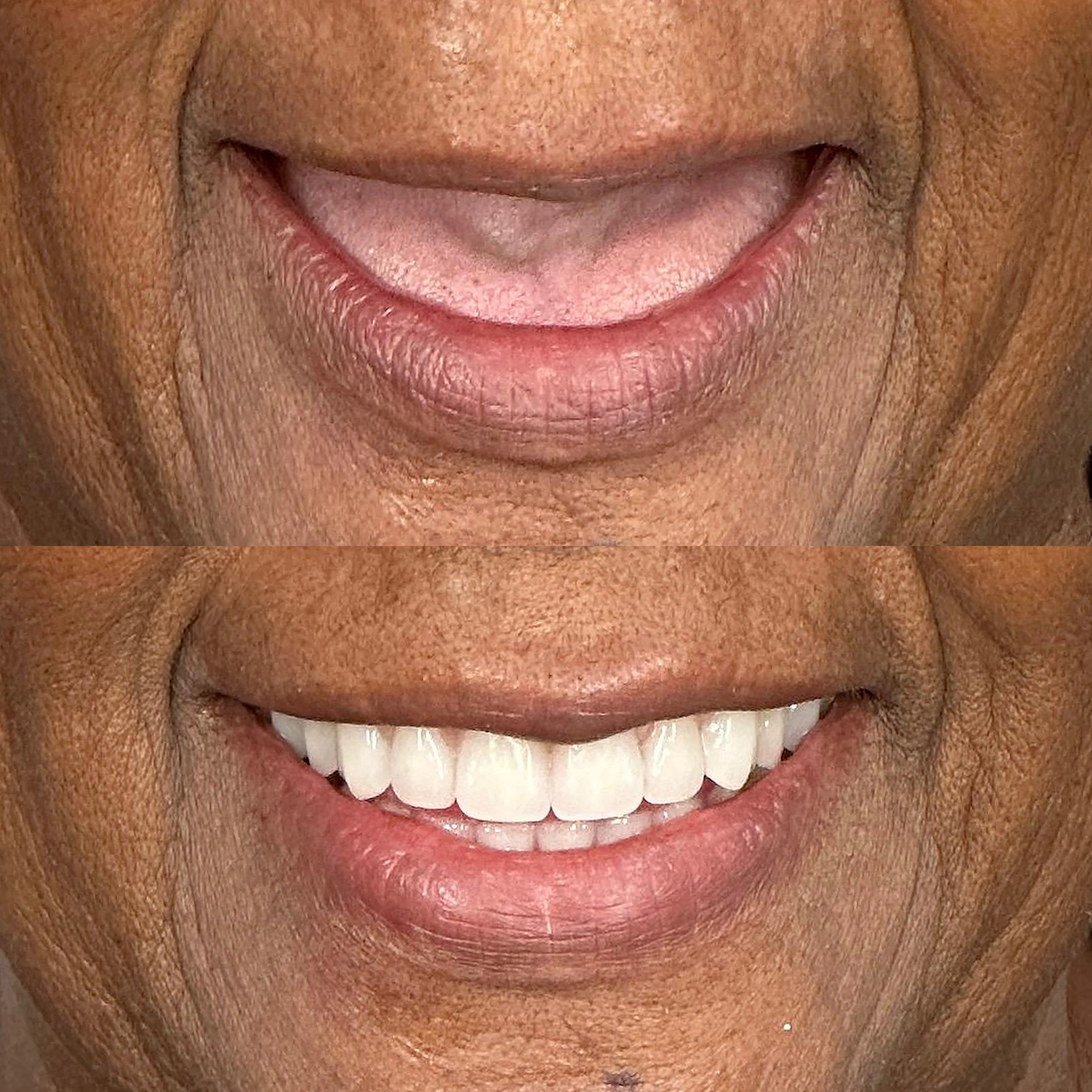 antes-depois-3