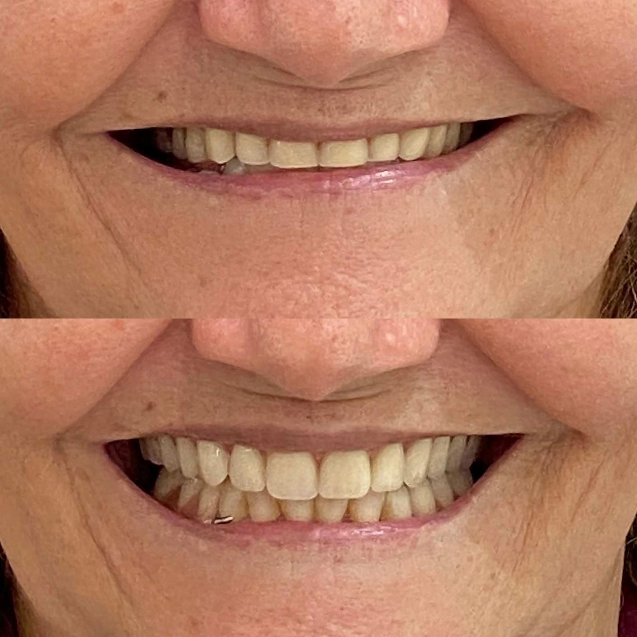 antes-depois-4