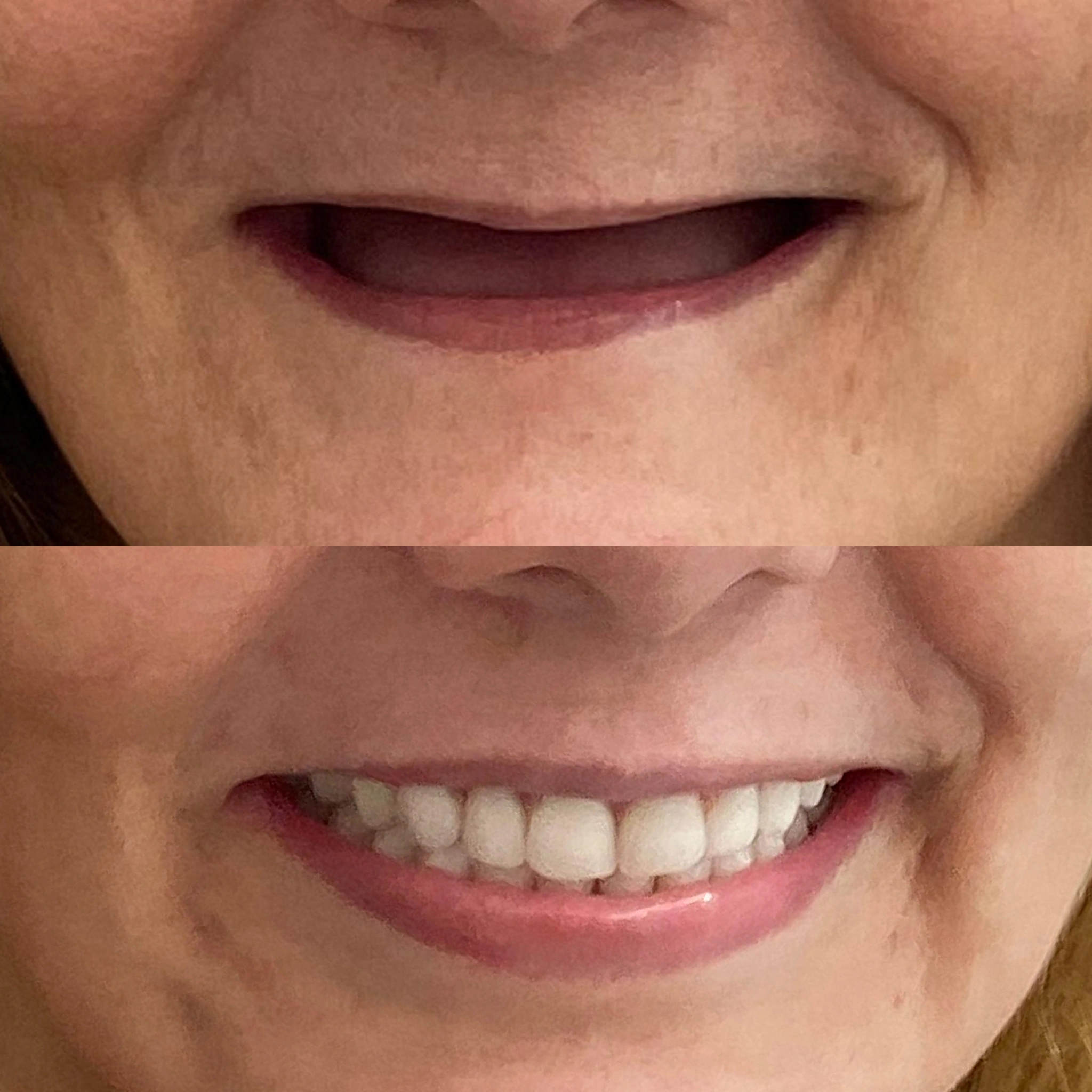antes-depois-5